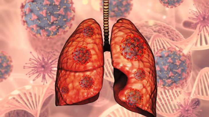 Lung Cancer Risk Factors: What Increases the Chances of Developing the Disease?