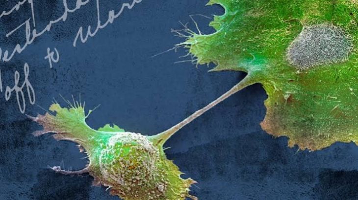 What Are the Different Types of Cancer and How Do They Affect the Body?