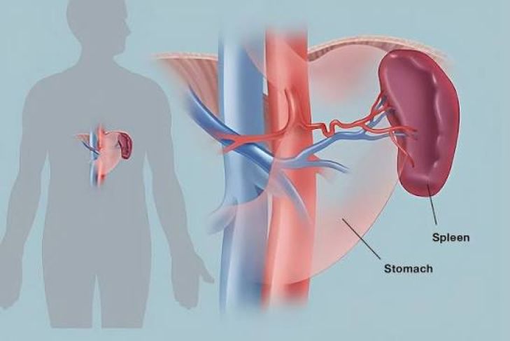 Common Spleen Disorders and Their Warning Signs