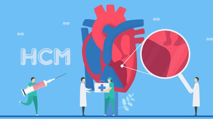 What Are the Symptoms and Risks of Cardiomyopathy?