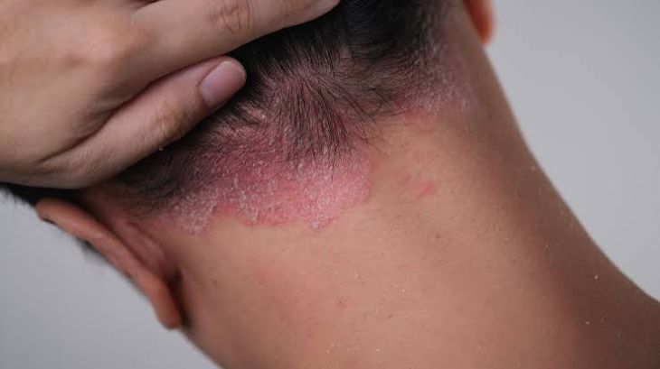 Common Skin Diseases and When They Need Medical Attention