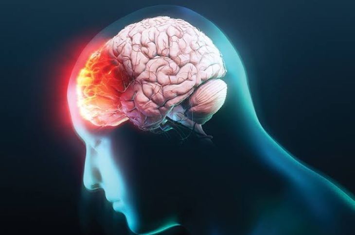 What Is a Concussion and How Can It Affect the Brain?