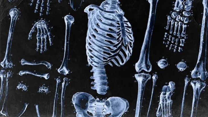 Common Bone Diseases and How to Protect Bone Health