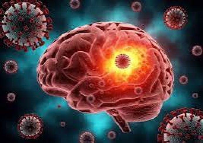 Understanding Brain Infections and Their Effects on the Body