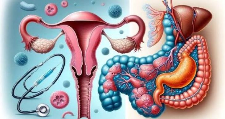 Understanding Endometriosis and Its Effects on the Body