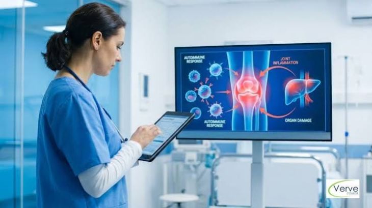 How Autoimmune Diseases Can Affect Different Organs