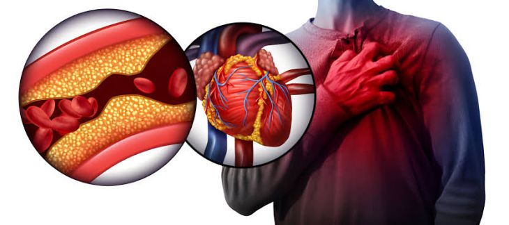 What Is Heart Block and How Is It Diagnosed?