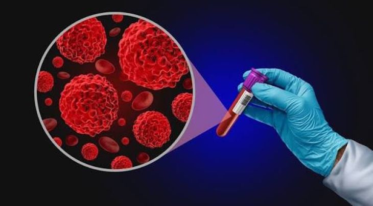 How Could Liquid Biopsy Technology Make Cancer Detection Faster?