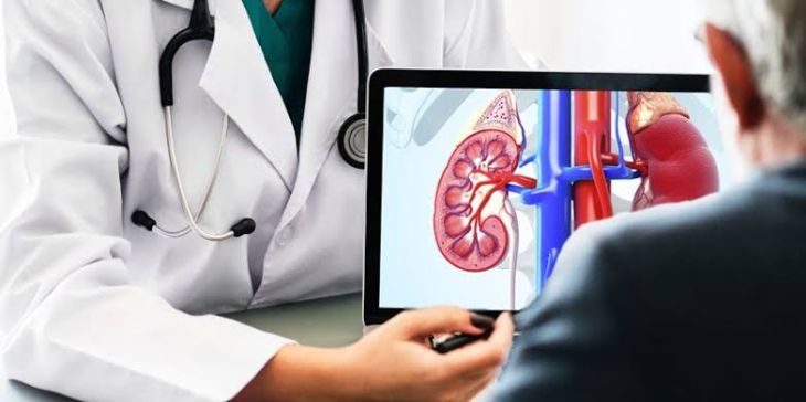 What Are the Symptoms, Risk Factors, and Diagnosis of Kidney Cancer?
