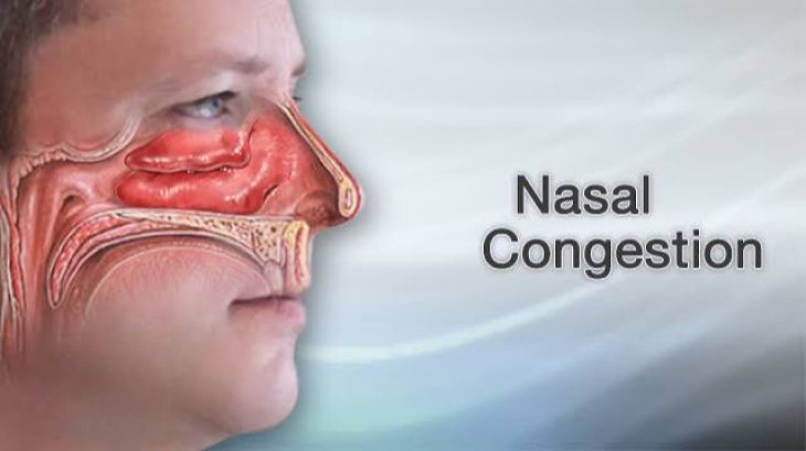 Understanding Decongestants: How They Relieve Nasal Congestion
