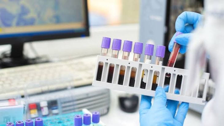 How Is Liquid Biopsy Technology Being Improved for Earlier Disease Detection?