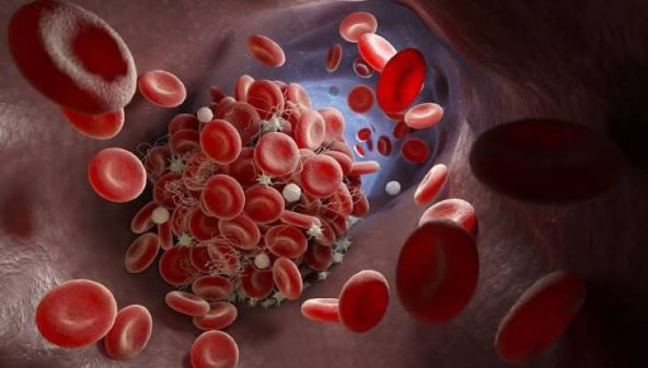 How Anticoagulant Medicines Help Prevent Dangerous Blood Clots