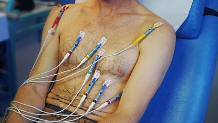 Understanding Brugada Syndrome and Its Effects on Heart Rhythm