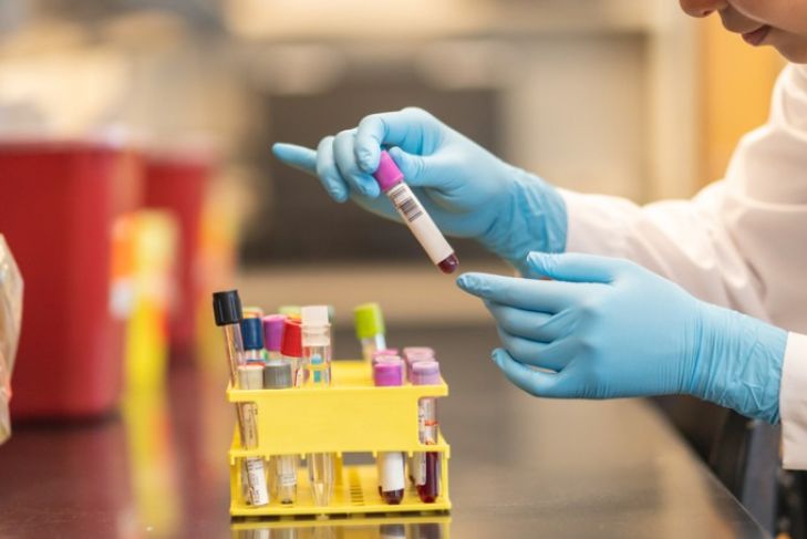 How AI-Powered Blood Tests Could Improve Early Disease Detection