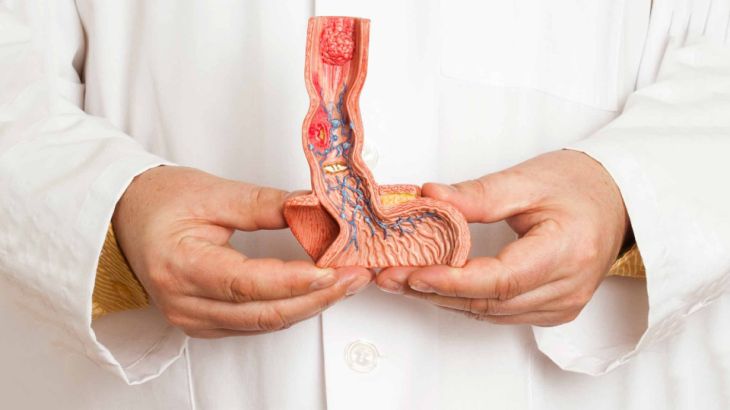 What Are the Risk Factors, Symptoms, and Diagnosis of Penile Cancer?