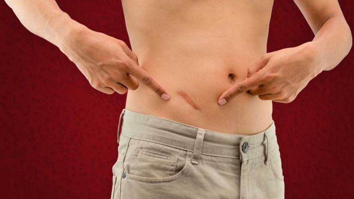 Common problems of the Appendix and Their warning signs