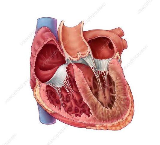 What Is Restrictive Cardiomyopathy and How Does It Affect the Heart?