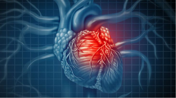 What Is Restrictive Cardiomyopathy and How Does It Affect the Heart?
