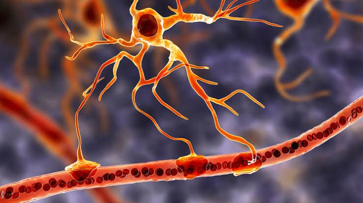 Understanding Primary Lateral Sclerosis and Its Effects on Movement