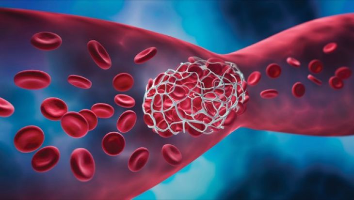 Understanding Anticoagulant Reversal Agents: How Doctors Manage Excessive Bleeding